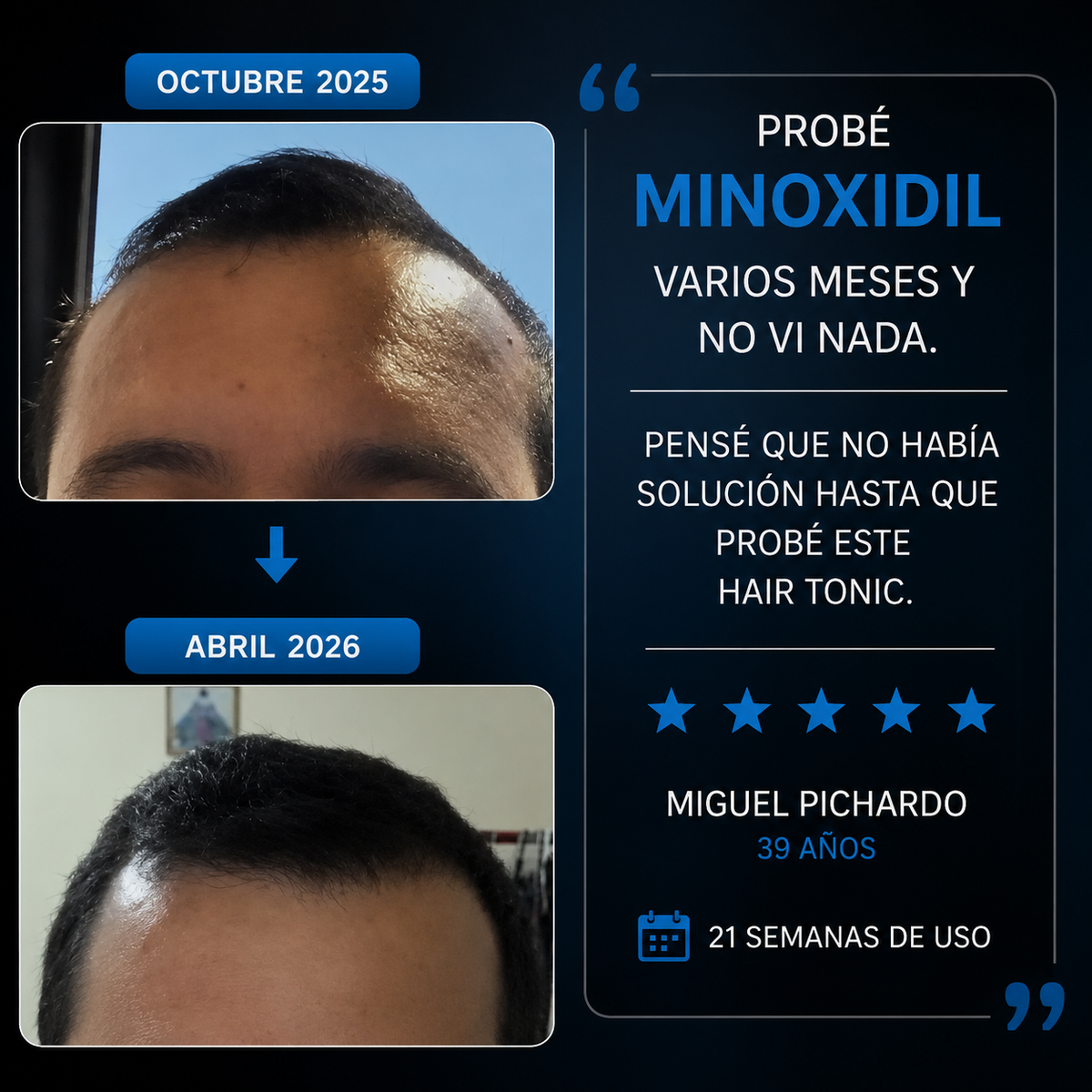 Folix Men
