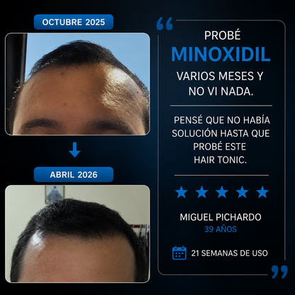 Folix Men